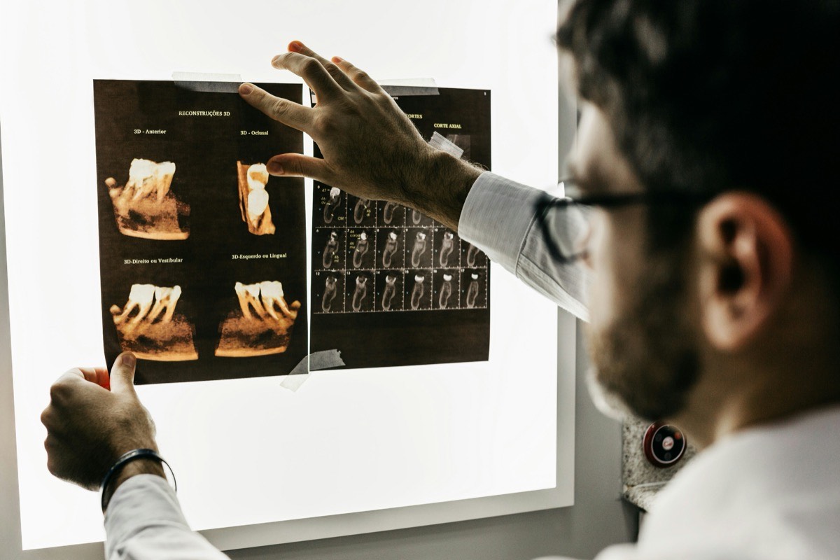 Zahnarzt analysiert 3D-Röntgenaufnahmen am Leuchtkasten
